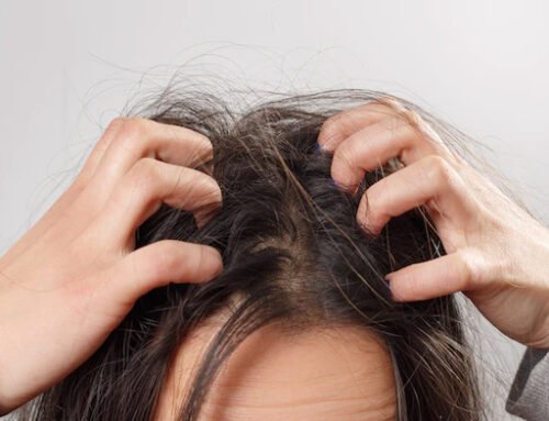 Scalp Infections Treatment