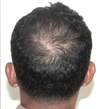 Before