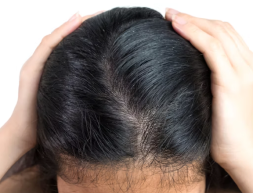 Healthy Scalp, Happy Hair: Understanding How Scalp Health Impacts Hair Growth