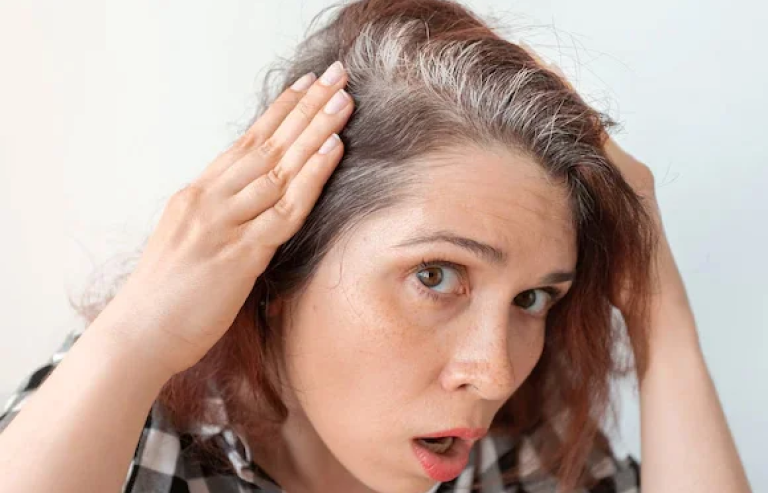  Premature graying treatment