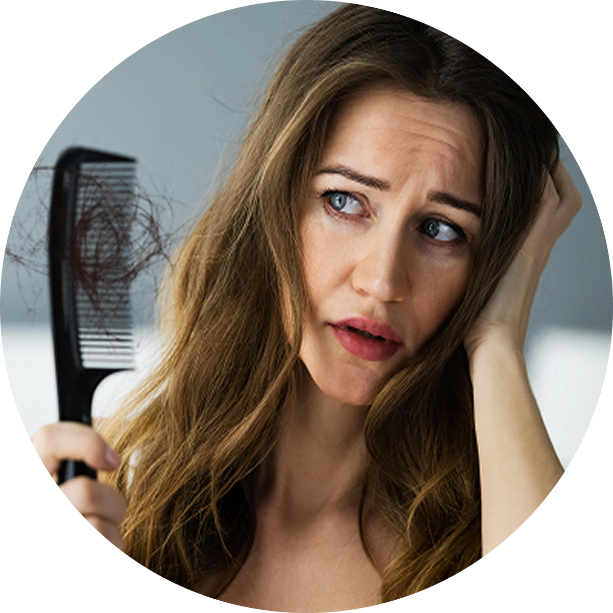 HAIR LOSS Ice Pick Scars