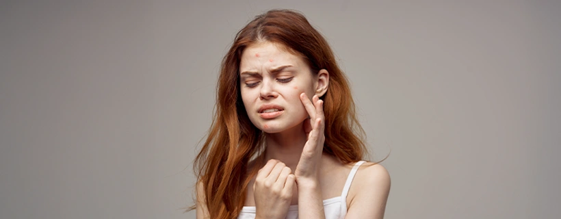 acne Common Symptoms acne Symptoms