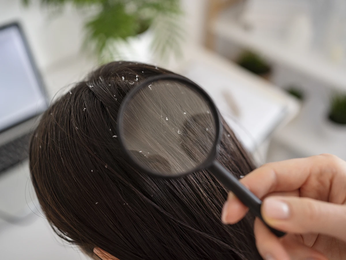 Good Dandruff Good Dandruff