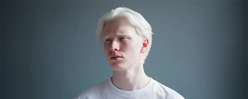 atopic-dermatitis Also Known as