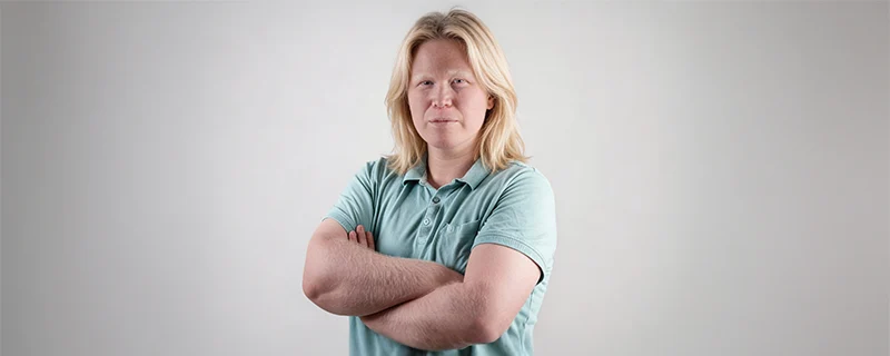 Acne Vulgaris affects