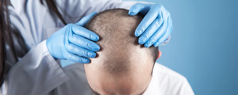 Common Symptoms Acne Vulgaris Causes