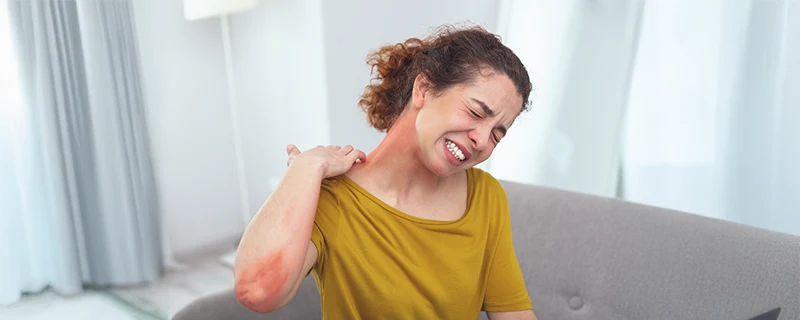 atopic-dermatitis Also Known as