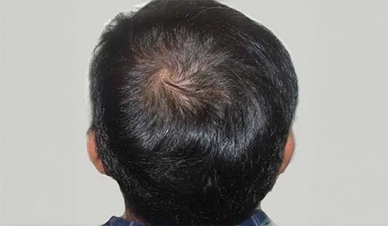 After