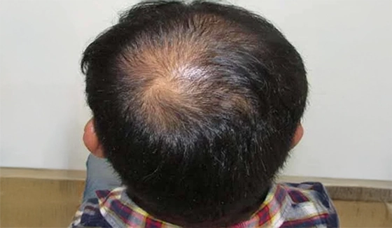 Before