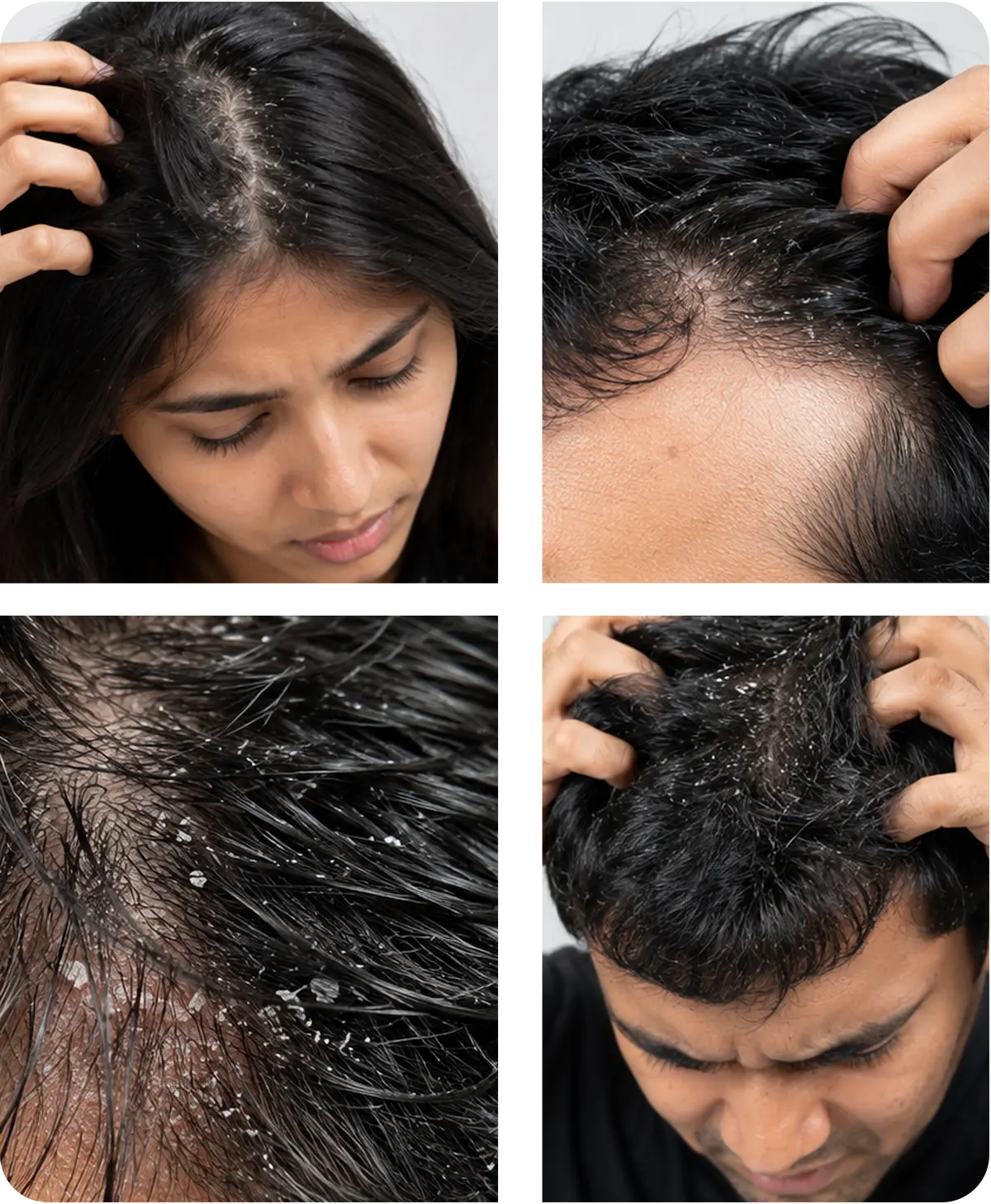 Banner (4) scalp treatment