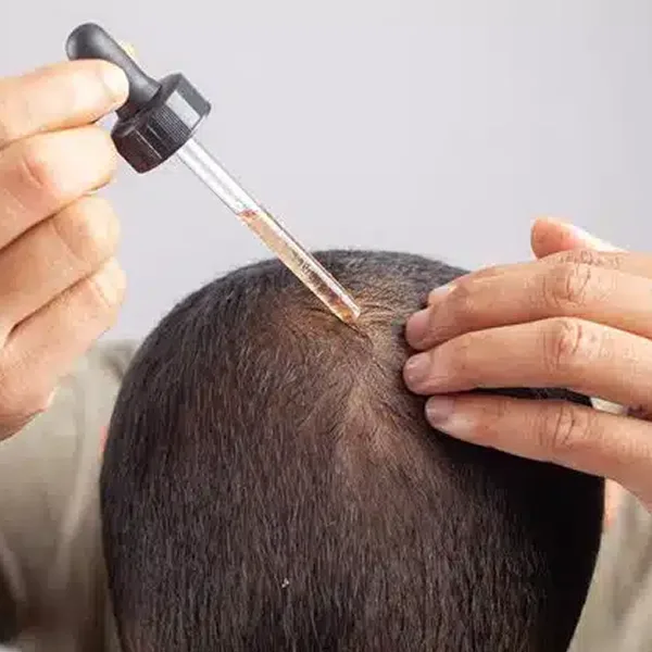 The Reality of Minoxidil Resistance The Reality of Minoxidil Resistance