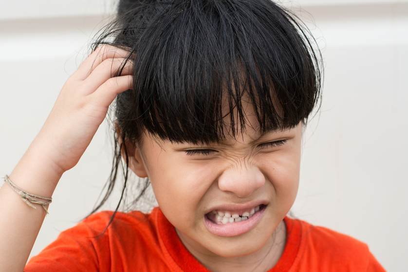 lice infestation Hormonal Acne